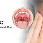Adenoidid Causes and Natural Care Explained