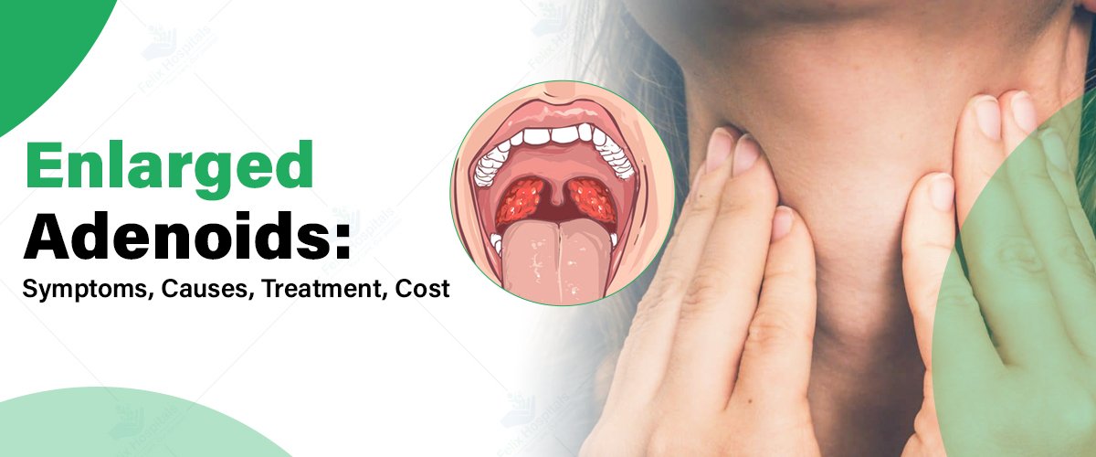 Adenoidid Causes and Natural Care Explaine