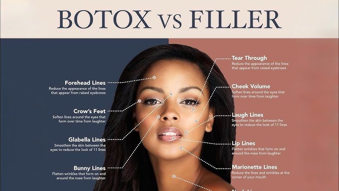 Botox vs Dermal Fillers: Which Treatment to Choose at Visit Anne Therese in Cape Coral?